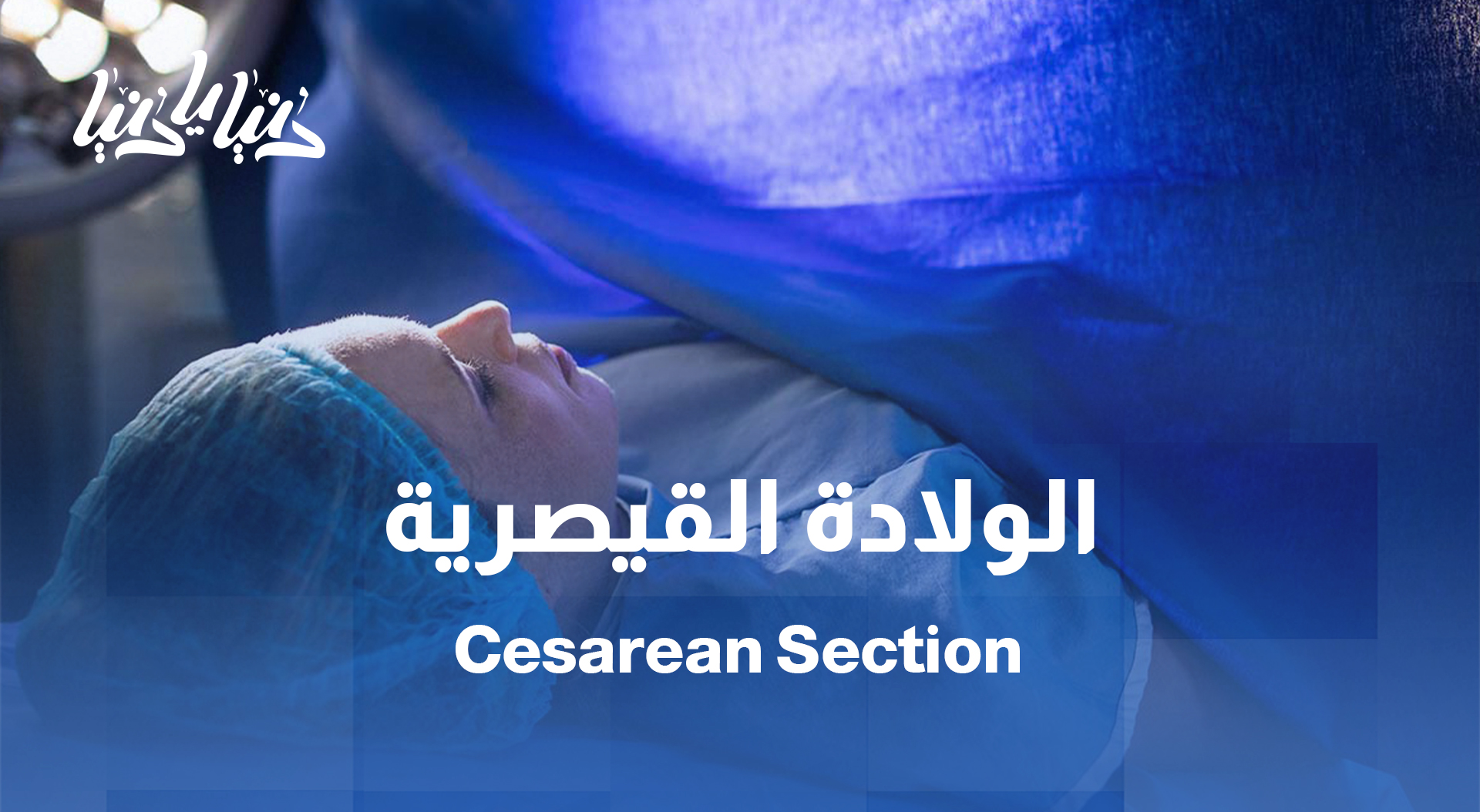 الولادة القيصرية: هل هي ضرورة أم ظاهرة؟