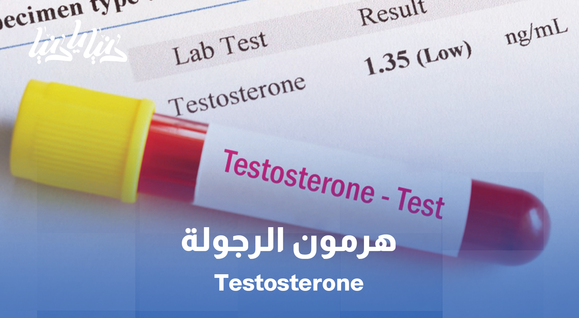 التستوستيرون وصحة الرجل: كيف يؤثر هرمون الذكورة على الجسد والعقل؟