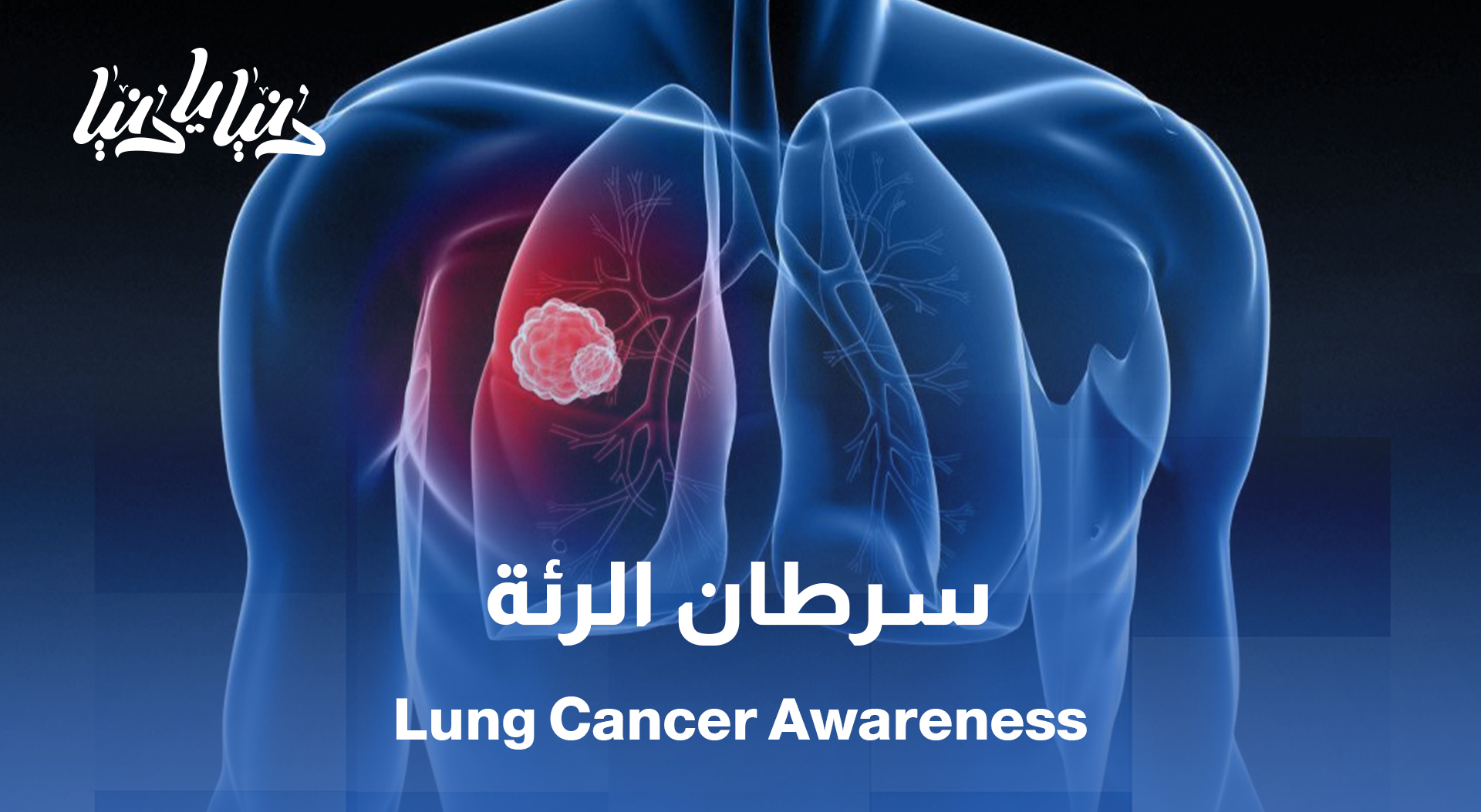 سرطان الرئة: الوقاية تبدأ من التنفس الصحي